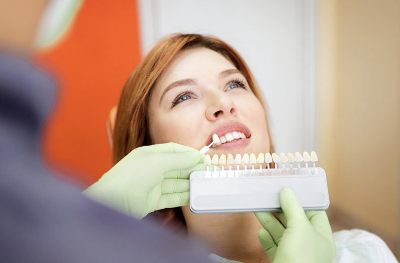 En el caso de las carillas, usamos una fina capa de porcelana de alta estética, para así camuflar defectos de color, forma o de posición en los dientes anteriores. En los casos de las carillas, con el objetivo de obtener una estética óptima, se recomienda colocarlas en todos los dientes anteriores (por lo menos los cuatro incisivos), para que estos queden simétricos. Las carillas y las fundas se unen a los dientes con cementos definitivos de resina o de ionomero  de vidrio.