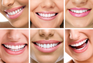 endoncia-guadalajara