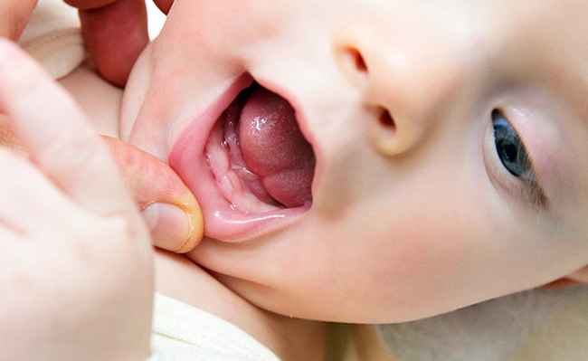 Los sarpullidos, la fiebre o la mucosidad son síntomas de los primeros dientes de tu bebé