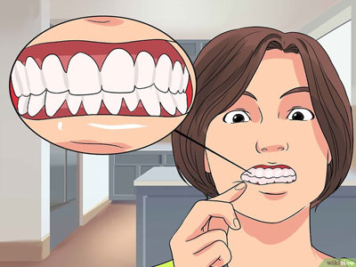 La anquilosis dental puede producirse tanto en las piezas temporales como en las permanentes pero es mucho más frecuente en las primeras. Y normalmente suele afectar mayoritariamente a los primeros molares inferiores.