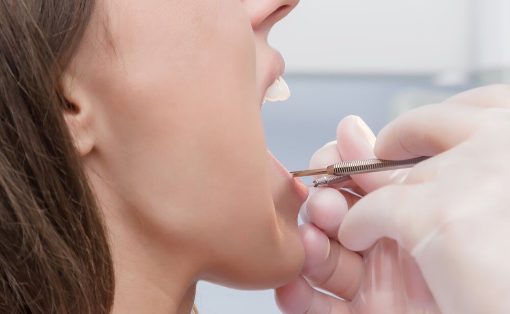 El Día de la Madre es una fecha para celebrar en familia y de regalos dentales. Porque, ¿quién no opina que su madre es la mejor madre del mundo? ¡Olvidemos las flores y los bombones! Una limpieza dental es uno de los tratamientos que siempre recomendamos una vez al año o cada seis meses. Para estos casos, lo ideal es retirar con cuidado la placa bacteriana con sus bacterias adheridas y eliminar las posibles manchas dentales para devolverle una sonrisa limpia.