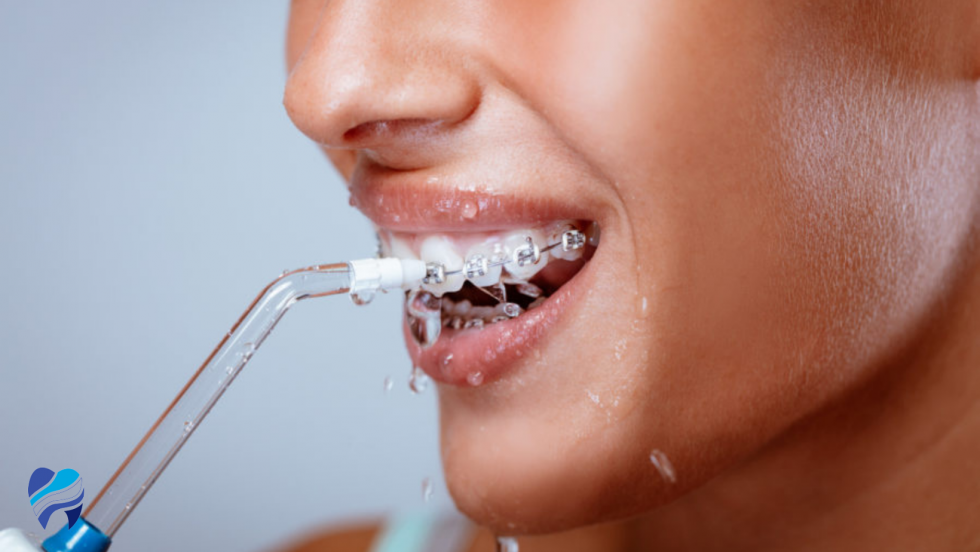 El irrigador dental es una herramienta que te ayuda a mejorar la limpieza dental diaria, gracias al agua a presión que se ejerce sobre las encías, entre los dientes y las líneas interproximales. Y aunque el cepillado dental debe ser un hábito diario en tu salud bucodental, el irrigador es el gran amigo higienizador que debes tener cerca.