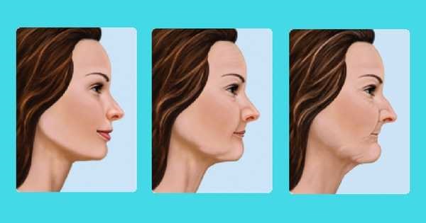El envejecimiento facial se produce por la pérdida de piezas dentales. De este modo, se confirma la relación de las arrugas del rostro por una pérdida ósea en tu mandíbula.