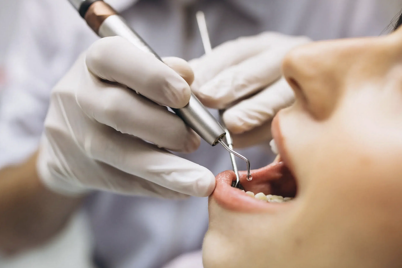 La endodoncia sin extracciones es uno de nuestros servicios que siempre prevalecemos en nuestra consulta de Clínica Dental Los Valles. Es cierto, siempre intentamos evitar la extracción de tus piezas dentales porque son fuente de salud oral. Pero, claro, todo depende de tu caso clínico. A