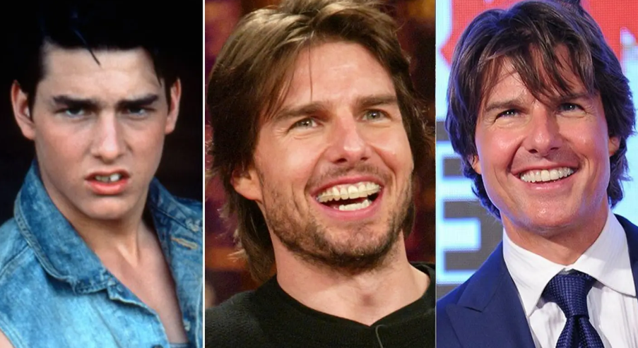 Tom Cruise es de los pocos famosos que decidió llevar brackets en su adultez, pero el resultado ha sido todo un acierto para este reconocido actor. 