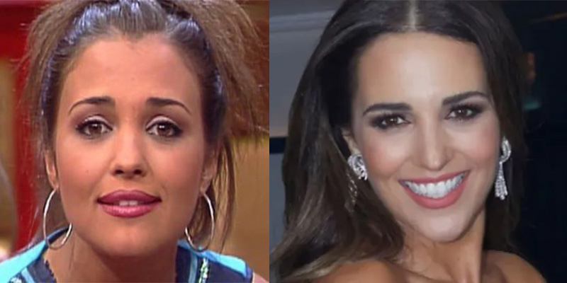 No es necesario ser famoso para poder cambiar tu sonrisa. Hay tratamientos bucodentales accesibles para todos los bolsillos