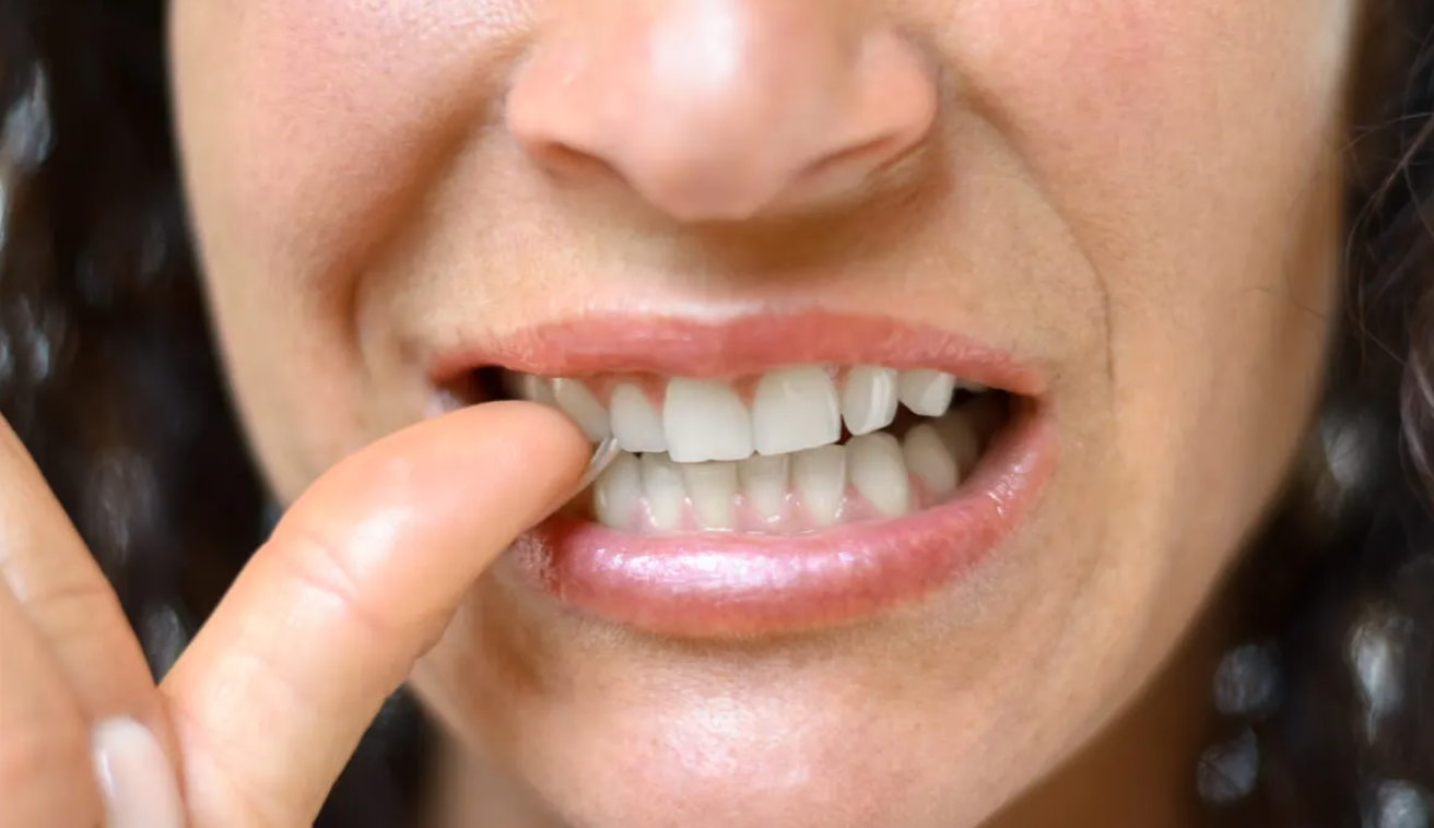 La tendencia de limarse los dientes con lima de uñas, ToothTok, se ha vuelto viral en las redes sociales. Porque estos vídeos consejos de los influencers que muestran un simple “truco estético” no muestran la agresión a su esmalte dental.