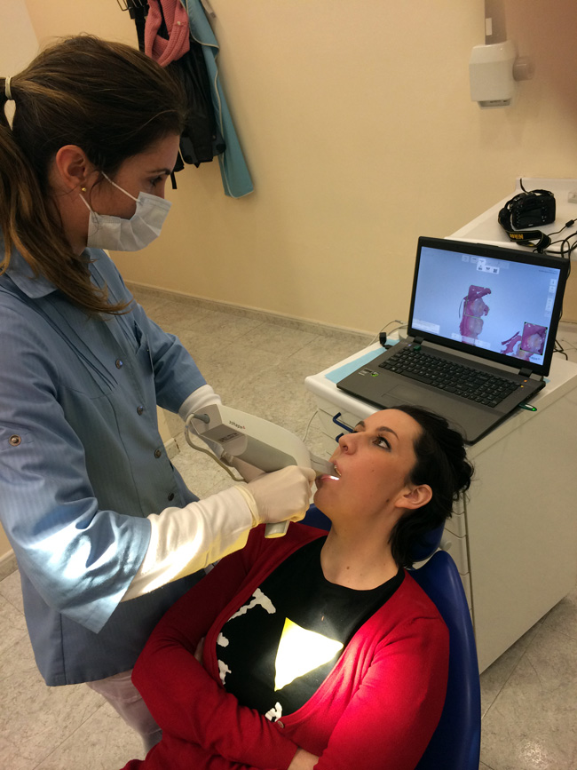tratamiento-escaner-intraoral-3shape-guadalajara Escaner-intraoral-3SHAPE