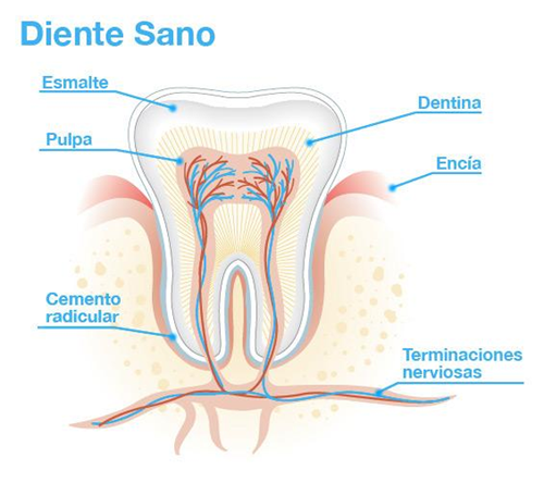 La caries interproximal aparece por la localización de la caries en tus dientes. 