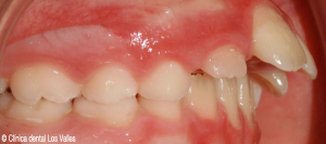 despues2-clinica-dental-guadalajara