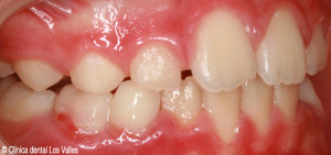 despues2-clinica-dental-guadalajara