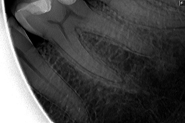 endodoncia+multirradicular endodoncia1multirradicular