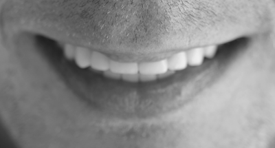 implantes-dentales-casos-clinicos implantesdentales3