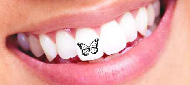 El odontólogo coloca una lámina fabricada con un material biocompatible  que podrás lucir de 15 a 20 días sobre tus dientes.